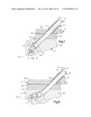 ANCHOR AND METHOD FOR SECURING A SUTURE diagram and image