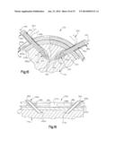 ANCHOR AND METHOD FOR SECURING A SUTURE diagram and image