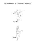 ANCHOR AND METHOD FOR SECURING A SUTURE diagram and image