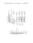 METACARPAL BONE STABILIZATION DEVICE diagram and image