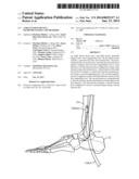 Ankle Fusion Device, Instrumentation and Methods diagram and image