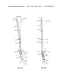 Ankle Fusion Device, Instrumentation and Methods diagram and image