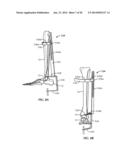 Ankle Fusion Device, Instrumentation and Methods diagram and image