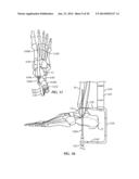 Ankle Fusion Device, Instrumentation and Methods diagram and image