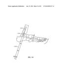 Ankle Fusion Device, Instrumentation and Methods diagram and image