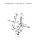 Ankle Fusion Device, Instrumentation and Methods diagram and image