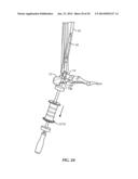 Ankle Fusion Device, Instrumentation and Methods diagram and image