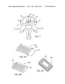 DEVICES AND METHODS FOR STABILIZING TISSUE AND IMPLANTS diagram and image