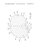 ASYMMETRIC TIBIAL COMPONENTS FOR A KNEE PROSTHESIS diagram and image