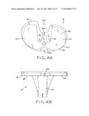 ASYMMETRIC TIBIAL COMPONENTS FOR A KNEE PROSTHESIS diagram and image