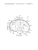 ASYMMETRIC TIBIAL COMPONENTS FOR A KNEE PROSTHESIS diagram and image