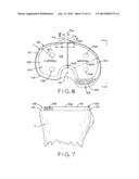 ASYMMETRIC TIBIAL COMPONENTS FOR A KNEE PROSTHESIS diagram and image