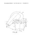 ASYMMETRIC TIBIAL COMPONENTS FOR A KNEE PROSTHESIS diagram and image