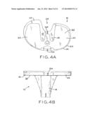 ASYMMETRIC TIBIAL COMPONENTS FOR A KNEE PROSTHESIS diagram and image