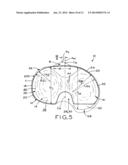 ASYMMETRIC TIBIAL COMPONENTS FOR A KNEE PROSTHESIS diagram and image