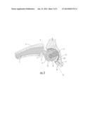 Interlocking Reverese Hip and Revision Prosthesis diagram and image