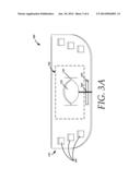 TRACHEOSTOMY DEVICES AND METHODS OF USE diagram and image