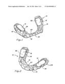 COMPOSITE ORAL APPLIANCES AND METHODS FOR MANUFACTURE diagram and image