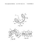 COMPOSITE ORAL APPLIANCES AND METHODS FOR MANUFACTURE diagram and image