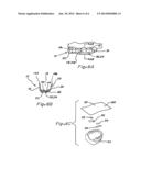 COMPOSITE ORAL APPLIANCES AND METHODS FOR MANUFACTURE diagram and image