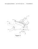 Flow Diverter Valve diagram and image