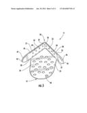 SURGICAL TRAY PROTECTION SYSTEM AND METHOD diagram and image