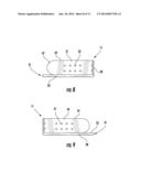 SURGICAL TRAY PROTECTION SYSTEM AND METHOD diagram and image