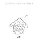 SURGICAL TRAY PROTECTION SYSTEM AND METHOD diagram and image