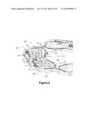 Camera Orientation Sensing Using Camera Module with MEMS AF Actuator diagram and image