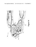 Camera Orientation Sensing Using Camera Module with MEMS AF Actuator diagram and image