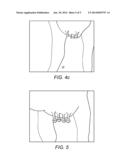 METHOD FOR LOCATING ANIMAL TEATS diagram and image