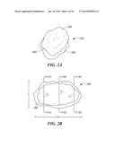 Patient Selectable Knee Arthroplasty Devices diagram and image