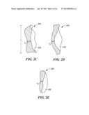 Patient Selectable Knee Arthroplasty Devices diagram and image