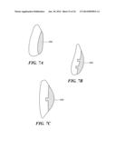 Patient Selectable Knee Arthroplasty Devices diagram and image