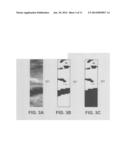 TUMOR CLASSIFICATION BASED ON AN ANALYSIS OF A RELATED ULTRASONIC     ATTENUATION MAP diagram and image