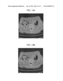 METHOD AND SYSTEM FOR GENERATING IMAGE USING FILTERED BACKPROJECTION WITH     NOISE WEIGHTING AND OR PRIOR IN diagram and image