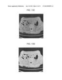 METHOD AND SYSTEM FOR GENERATING IMAGE USING FILTERED BACKPROJECTION WITH     NOISE WEIGHTING AND OR PRIOR IN diagram and image