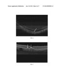 DIFFERENTIAL GEOMETRIC METRICS CHARACTERIZING OPTICAL COHERENCE TOMOGRAPHY     DATA diagram and image