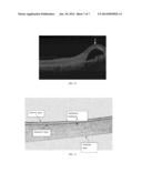 DIFFERENTIAL GEOMETRIC METRICS CHARACTERIZING OPTICAL COHERENCE TOMOGRAPHY     DATA diagram and image