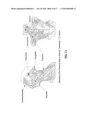 INJECTION PARADIGM FOR ADMINISTRATION OF BOTULINUM TOXINS diagram and image