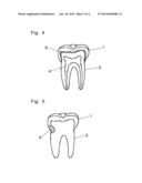 TOOTH FOR DENTAL ARCH MODEL AND METHOD FOR PRODUCING THE SAME diagram and image