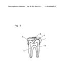 TOOTH FOR DENTAL ARCH MODEL AND METHOD FOR PRODUCING THE SAME diagram and image