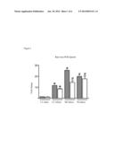 GPNMB/OSTEOACTIVIN AS A BIOMARKER AND DRUG TARGET IN CARDIAC DISEASES diagram and image