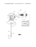 BONE TREATMENT SYSTEMS AND METHODS diagram and image