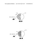 BONE TREATMENT SYSTEMS AND METHODS diagram and image