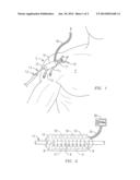 Method and Apparatus for Conducting Blood Testing While Conserving the     Blood of a Critically Ill Patient diagram and image