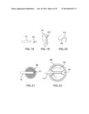 Sensor Inserter Having Introducer diagram and image