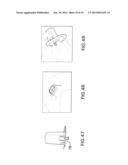 Sensor Inserter Having Introducer diagram and image