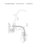 TRACHEAL TUBE SENSOR DISPOSED ON PERMEABLE MEMBRANE diagram and image