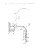 TRACHEAL TUBE SENSOR DISPOSED ON PERMEABLE MEMBRANE diagram and image